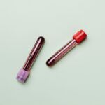 ¿Cómo fabrica nuestro cuerpo la Sangre?
