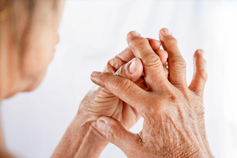 Artritis: ¿Qué es? ¿Qué tipos existen? ¿Cómo prevenirla?