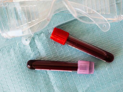 Tubos de ensayo con muestras de sangre para análisis de triglicéridos y control del colesterol en laboratorio clínico