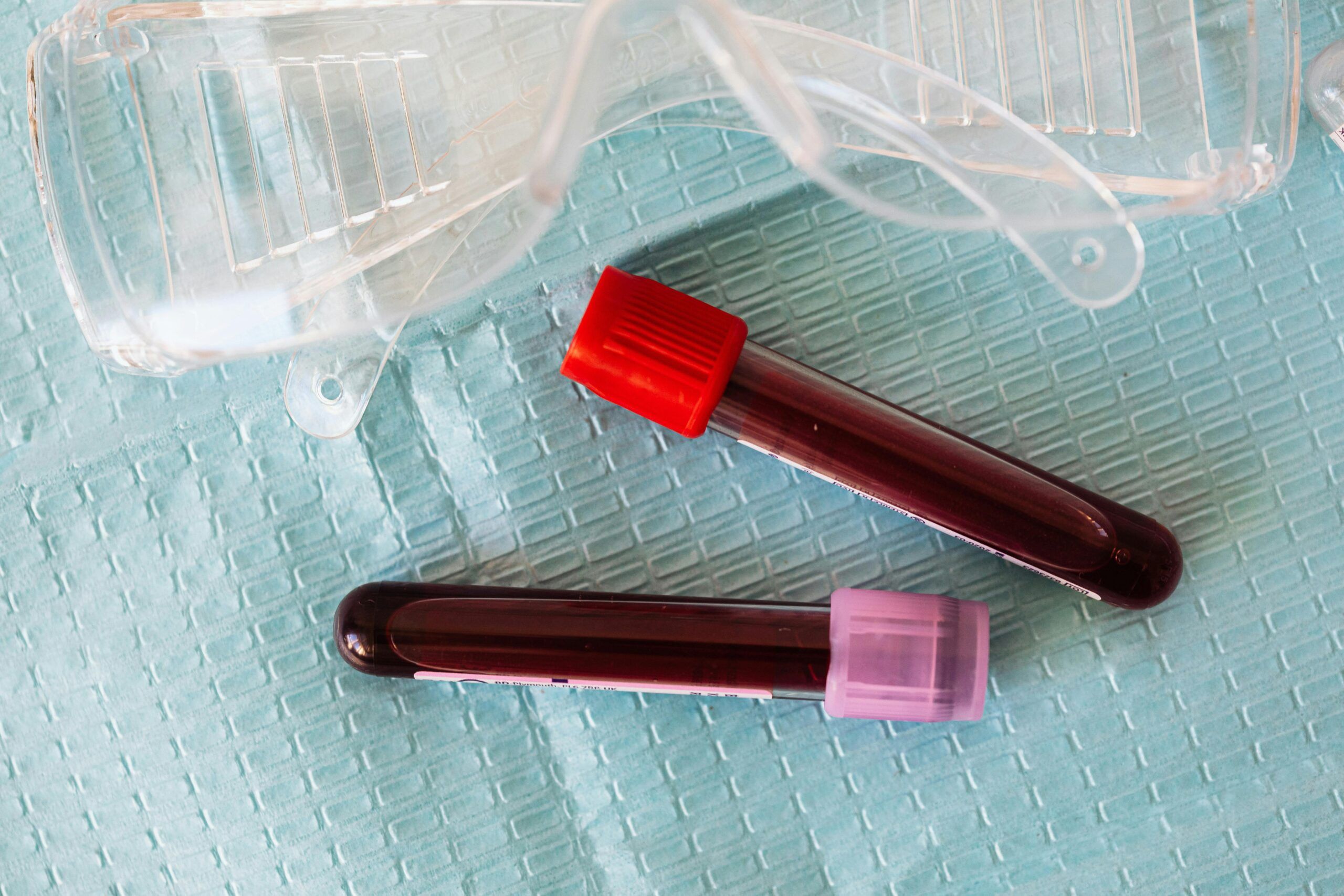 Tubos de ensayo con muestras de sangre para análisis de triglicéridos y control del colesterol en laboratorio clínico