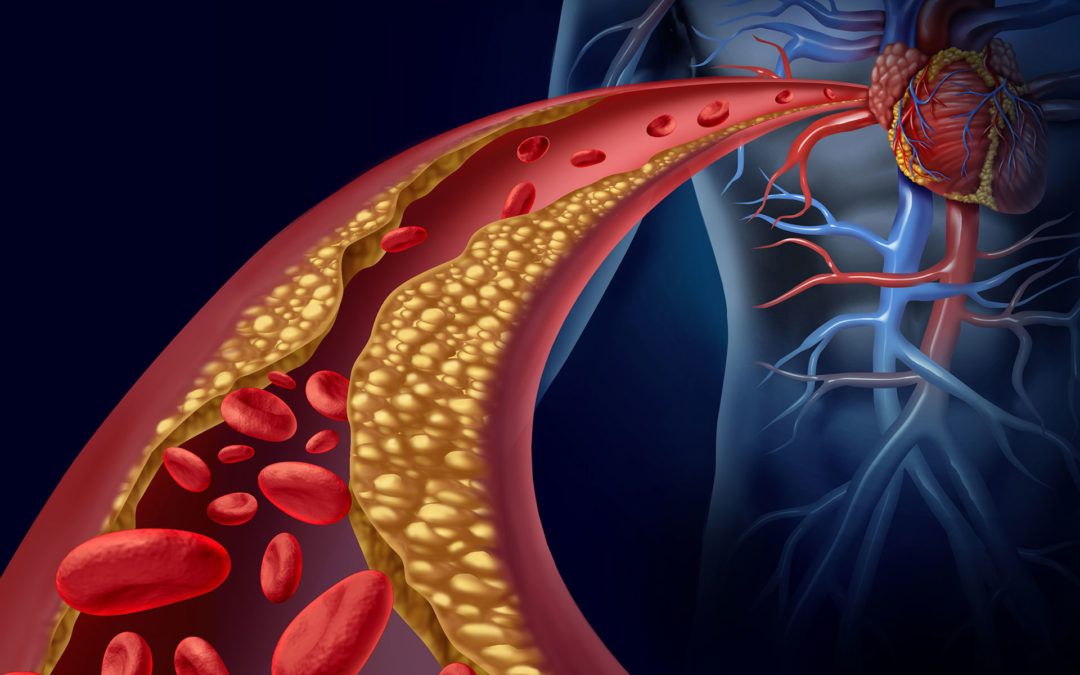 Suplementos Naturales para Controlar el Colesterol y los Triglicéridos