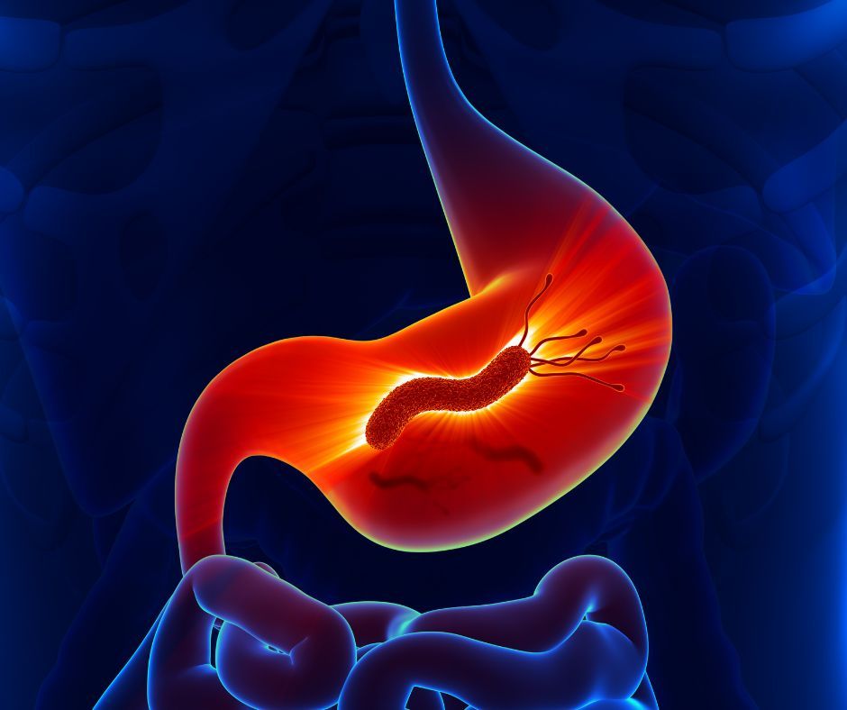 El Remedio Natural más Eficaz contra el Helicobacter Pylori