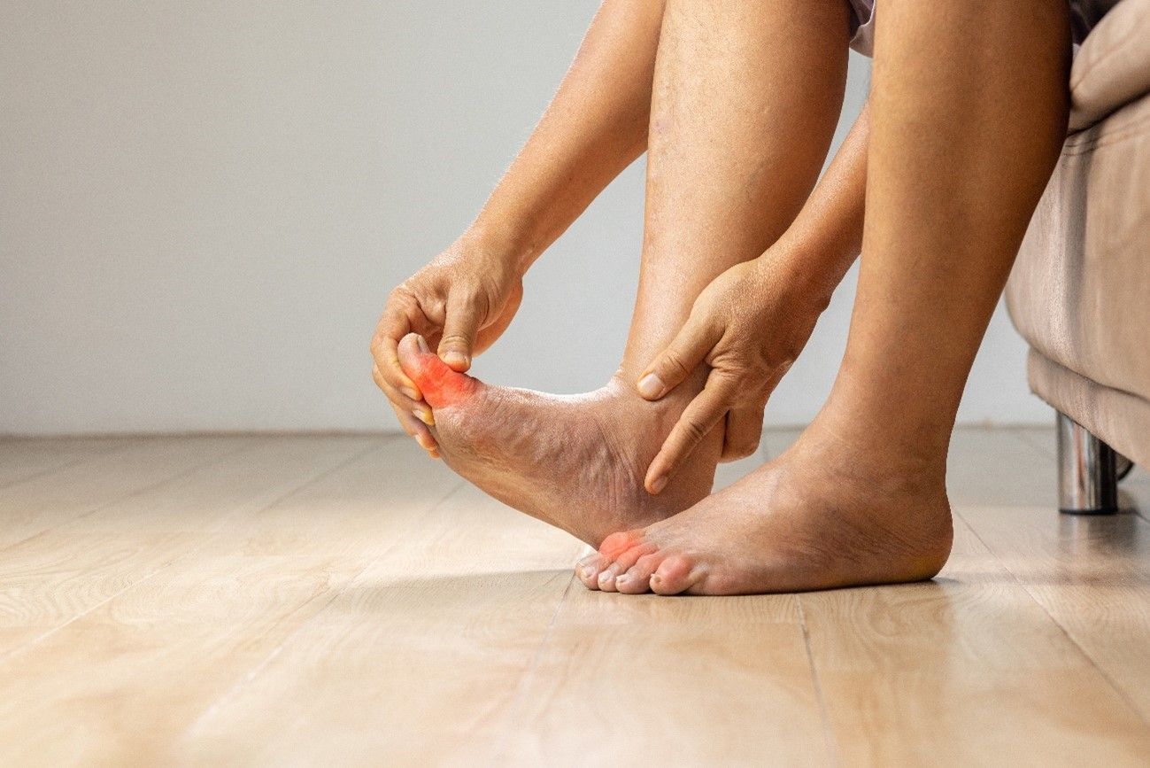Baja tu Ácido Úrico de Forma Natural Con Estos Consejos Efectivos