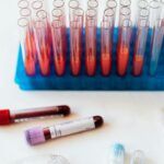 Triglicéridos altos: causas, riesgos y cómo bajarlos de forma efectiva