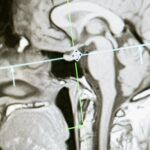 Resonancia magnética del cerebro humano relacionada con el estudio de la conciencia y la percepción según Jacobo Grinberg